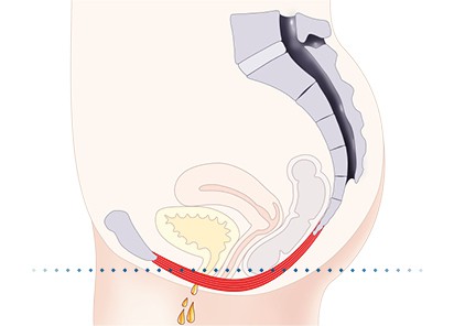 Pelvic floor muscles Gosport 