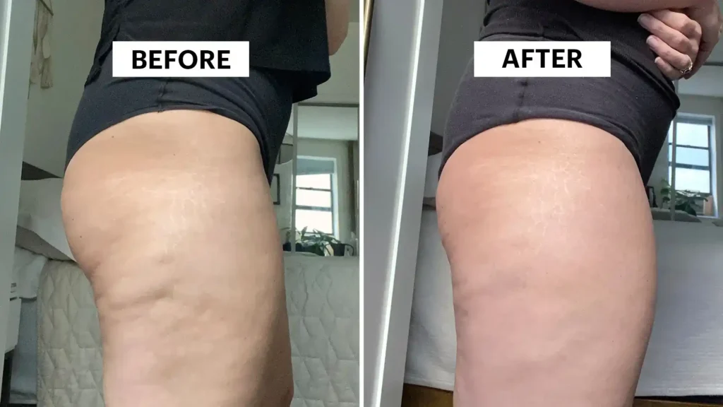 Do Toning Exercise Gosport  Really Tackle Cellulite?