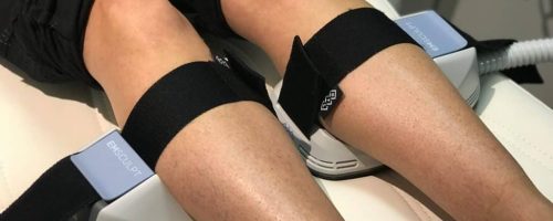 LIPO360 Body Sculpt Areas We Treat Gosport  Calves (Lower Legs)